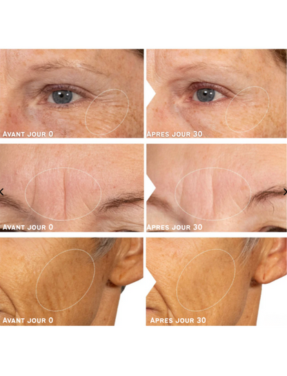 Sérum Visage au Rétinol – Valéa